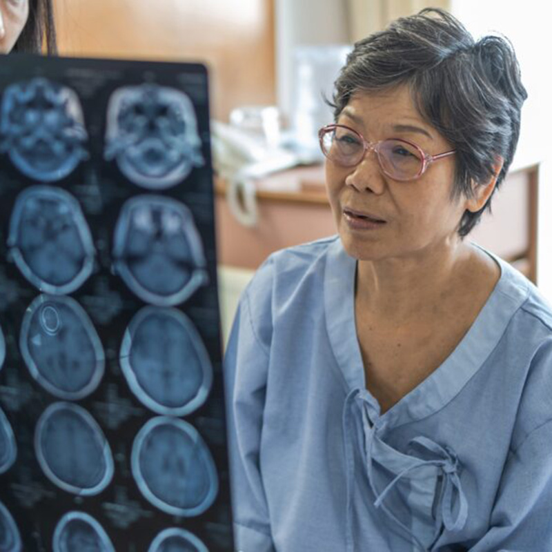 Vision Impairment After Stroke